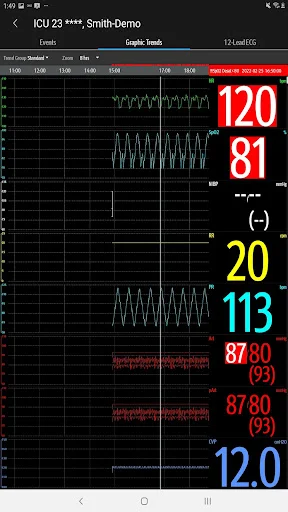 Mindray Mobile Viewer ڈاؤن لوڈ کریں – طبی نگرانی اب آپ کے موبائل پر - Screenshot 15