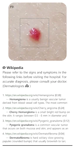 Model Dermatol ڈاؤن لوڈ کریں – جلد کی بیماریوں کی تشخیص ایپ - Screenshot 5