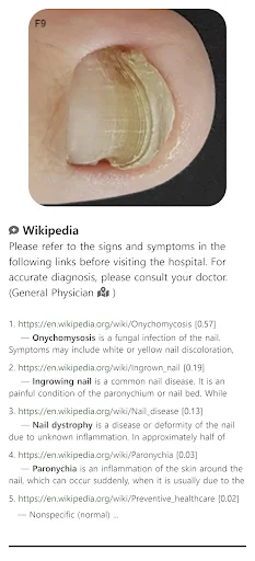 Model Dermatol ڈاؤن لوڈ کریں – جلد کی بیماریوں کی تشخیص ایپ - Screenshot 1
