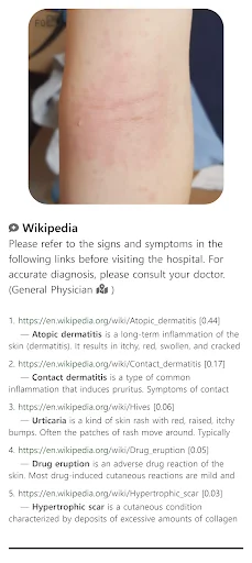 Model Dermatol ڈاؤن لوڈ کریں – جلد کی بیماریوں کی تشخیص ایپ - Screenshot 7