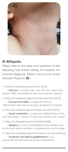 Model Dermatol ڈاؤن لوڈ کریں – جلد کی بیماریوں کی تشخیص ایپ - Screenshot 6