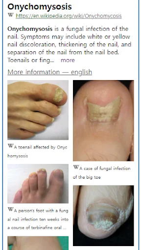 Model Dermatol ڈاؤن لوڈ کریں – جلد کی بیماریوں کی تشخیص ایپ - Screenshot 2